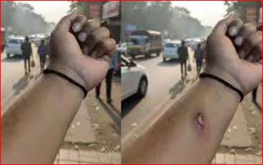 AI-edited photo sparks debate after HR approves leave based on fake injury